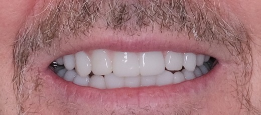 Gps Smile 1