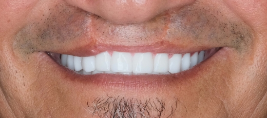 Gps Smile 2