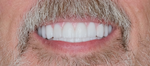 Gps Smile 4